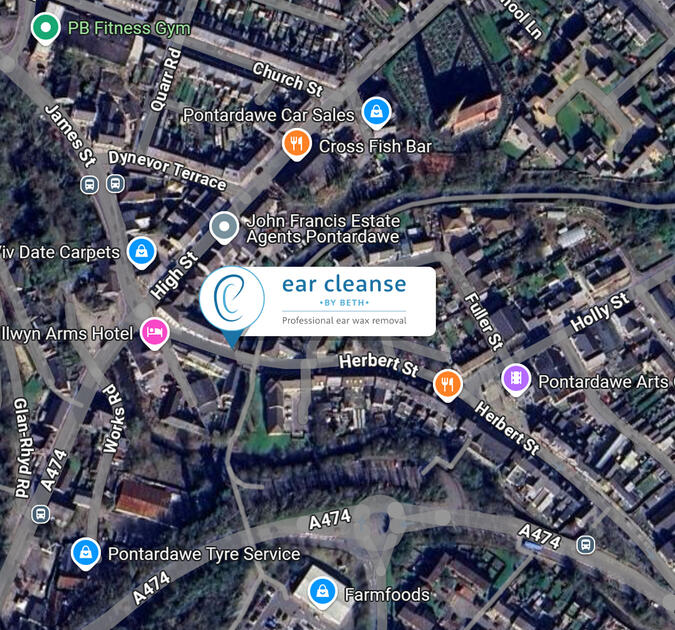 ear cleanse by Beth is located at 12a Herbert Street Pontardawe